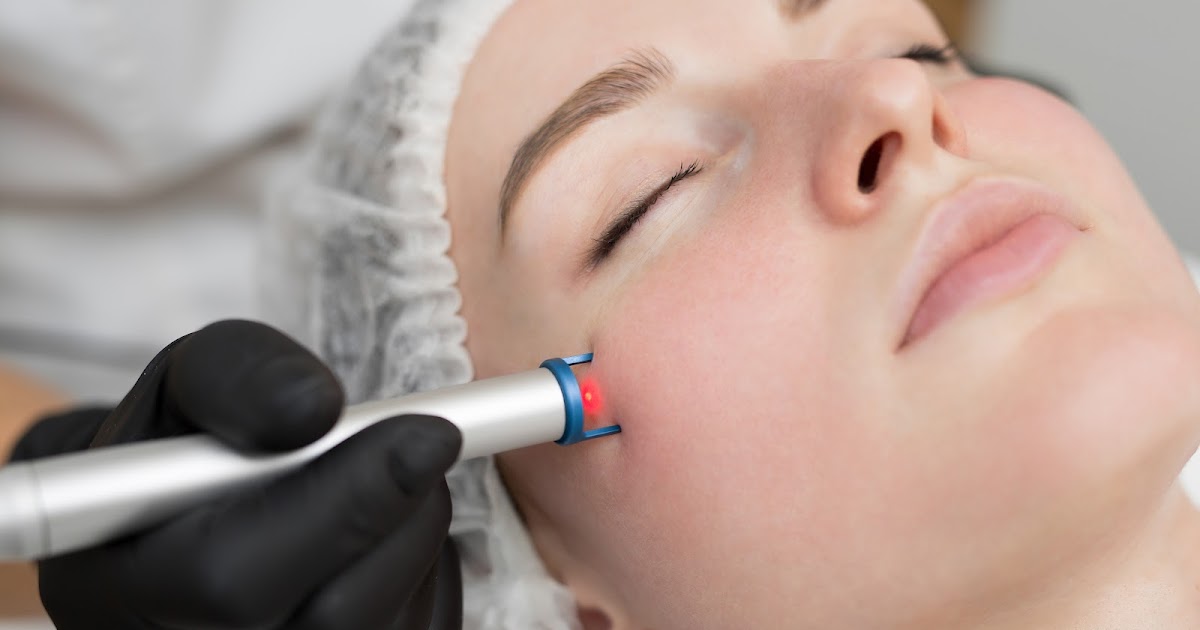 Why Fractional Laser is Delhi's Go-To Solution for Acne Scars?